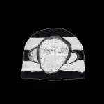 Billionaire Studios Bluto Orb Beanie (1)